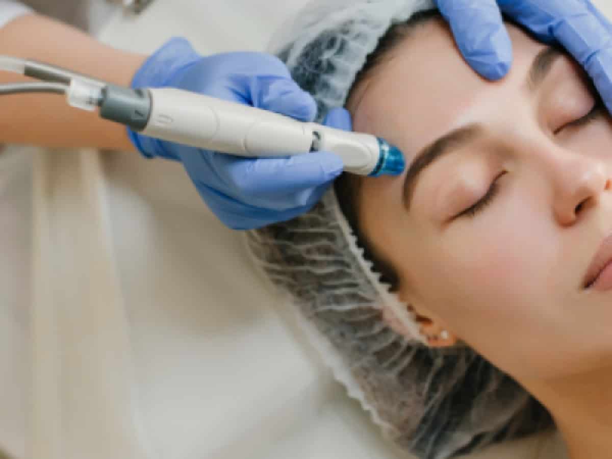 Plasma Pen Faltenreduzierung Plasma Pen Faltenreduzierung